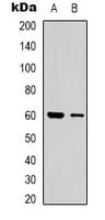 CLIP3 Antibody (Internal)