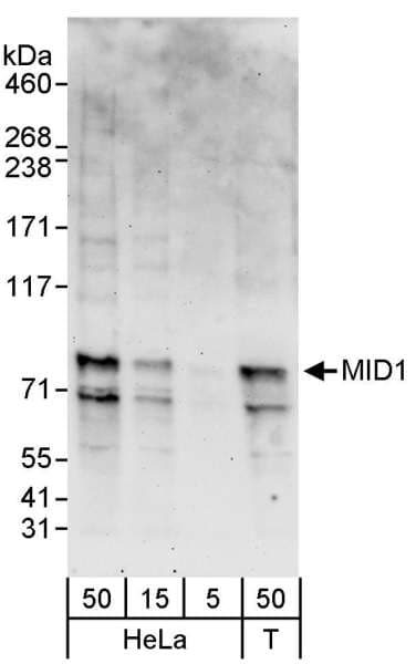 MID1 Antibody (aa617-667)