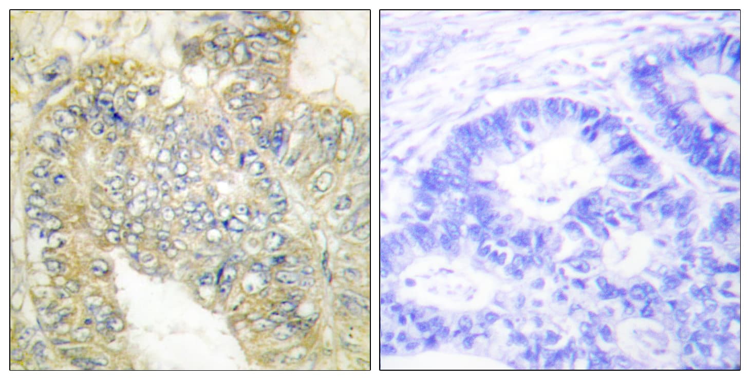 DES / Desmin Antibody (phospho-Ser60)