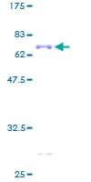 Human DCX / Doublecortin Protein (Recombinant GST)