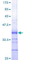 Human CDC6 Protein (Recombinant GST, N-terminus)