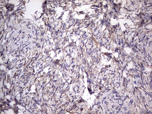 Monoclonal Mouse anti-Human CD63 Antibody (clone OTI5E5, IHC, WB)