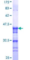 Human VR1 / TRPV1 Protein (Recombinant GST, N-terminus)