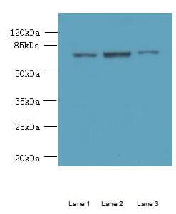 CCDC116 Antibody (Coiled-coil domain)