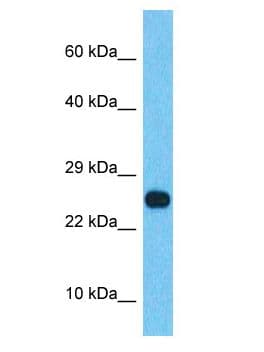 SSX2B Antibody (aa21-70)