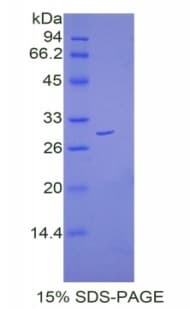 Mouse CTNNB1 / Beta Catenin Protein (Recombinant His)