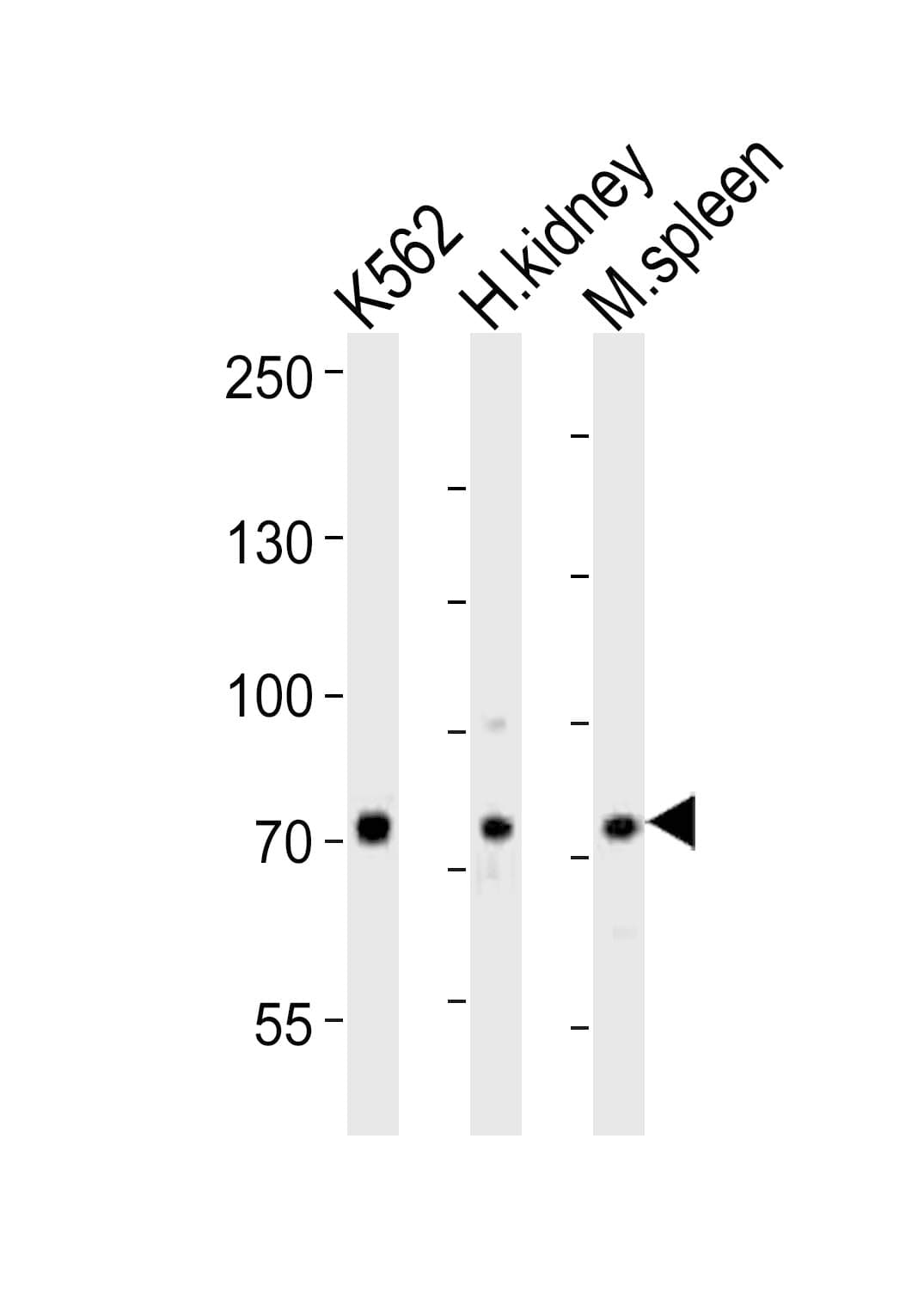 Polyclonal Rabbit anti-Human SDAD1 Antibody (aa596-629, WB)