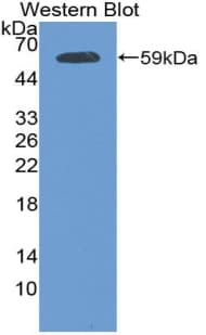 PKP1 / Plakophilin 1 Antibody (aa500-742)