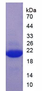 Chicken IL-1B / IL-1 Beta Protein (Recombinant His, N-Terminal)