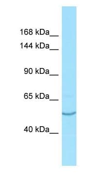 AASS / LKR / SDH Antibody (aa268-317)