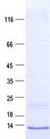 Human LEAP2 Protein (Recombinant His, N-Terminal)