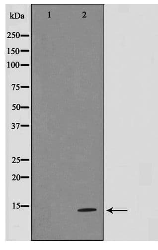 Polyclonal Rabbit anti-Human SUMO1 / SMT3 Antibody (IHC, IF, WB)
