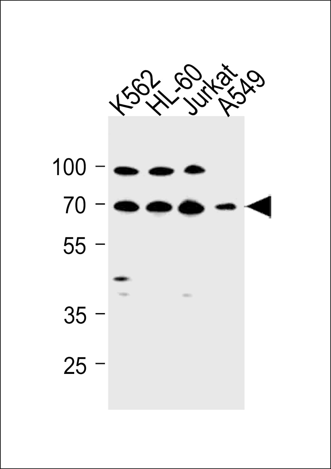 GABRQ / THETA Antibody (aa585-613)
