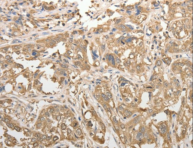 ADHFE1 Antibody