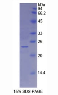 Human ESM1 / Endocan Protein (Recombinant His)