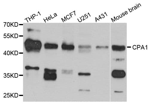 Polyclonal Rabbit anti-Human CPA1 / Carboxypeptidase A Antibody (WB)