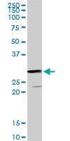 GSTZ1 Antibody (clone 1G12)