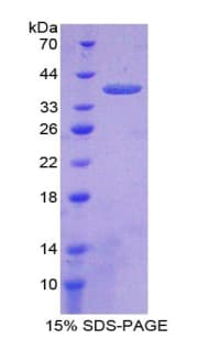 Human MCL1 / MCL 1 Protein (Recombinant His-T7)