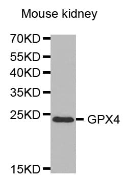 Polyclonal Rabbit anti-Human GPX4 / MCSP Antibody (IHC, IF, WB)