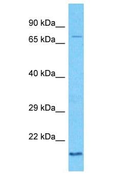 KBTBD6 Antibody (aa237-286)