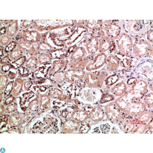 KIR2DL5A / KIR2DL5 Antibody