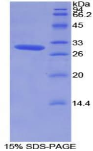 Mouse ROR1 Protein (Recombinant His-T7)