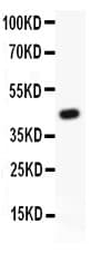 ATF2 Antibody (aa93-450)