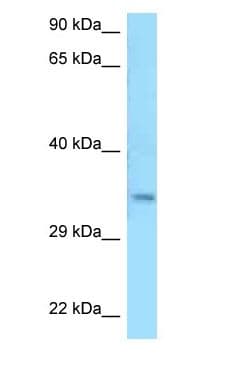 MSANTD3 Antibody (aa175-224)