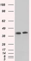 ACAT2 Antibody (clone OTI5F7)
