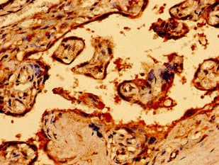 Neurofibromin / NF1 Antibody