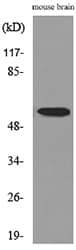 Polyclonal Rabbit anti-Human CPE / Carboxypeptidase E Antibody (WB)
