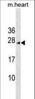 INCA1 Antibody (aa14-42)