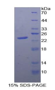 Human PTPRN / IA-2 Protein (Recombinant His)