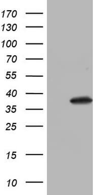 NKX3-1 Antibody (clone OTI6E7)