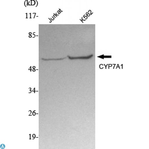 CYP7A1 Antibody (clone 3D5)