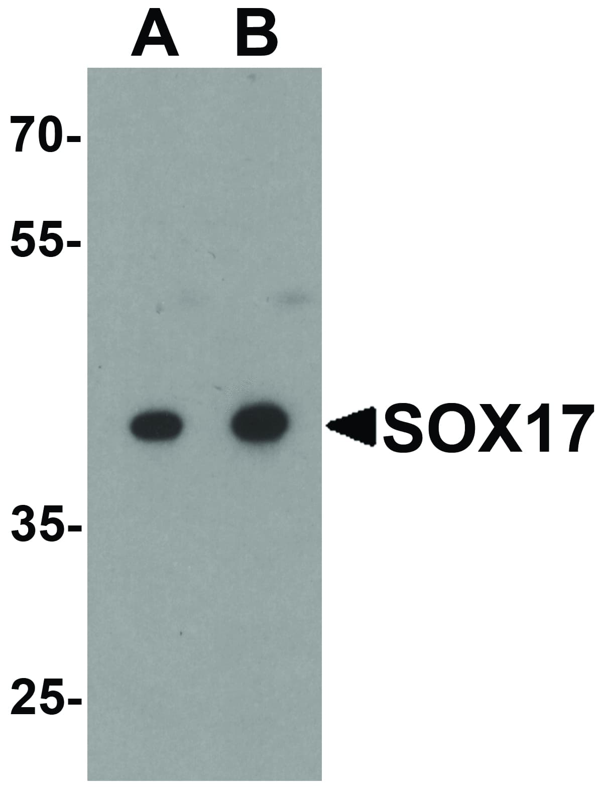SOX17 Antibody
