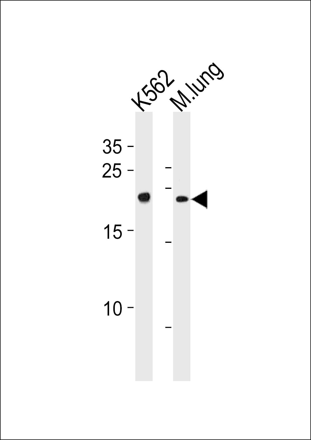 Polyclonal Rabbit anti-Human CBFB Antibody (aa61-90, IHC, IF, WB)