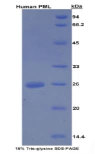 Human PML Protein (Recombinant His-S)