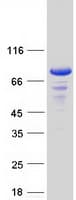 Human ETK / BMX Protein (Recombinant Myc-DDK (Flag))