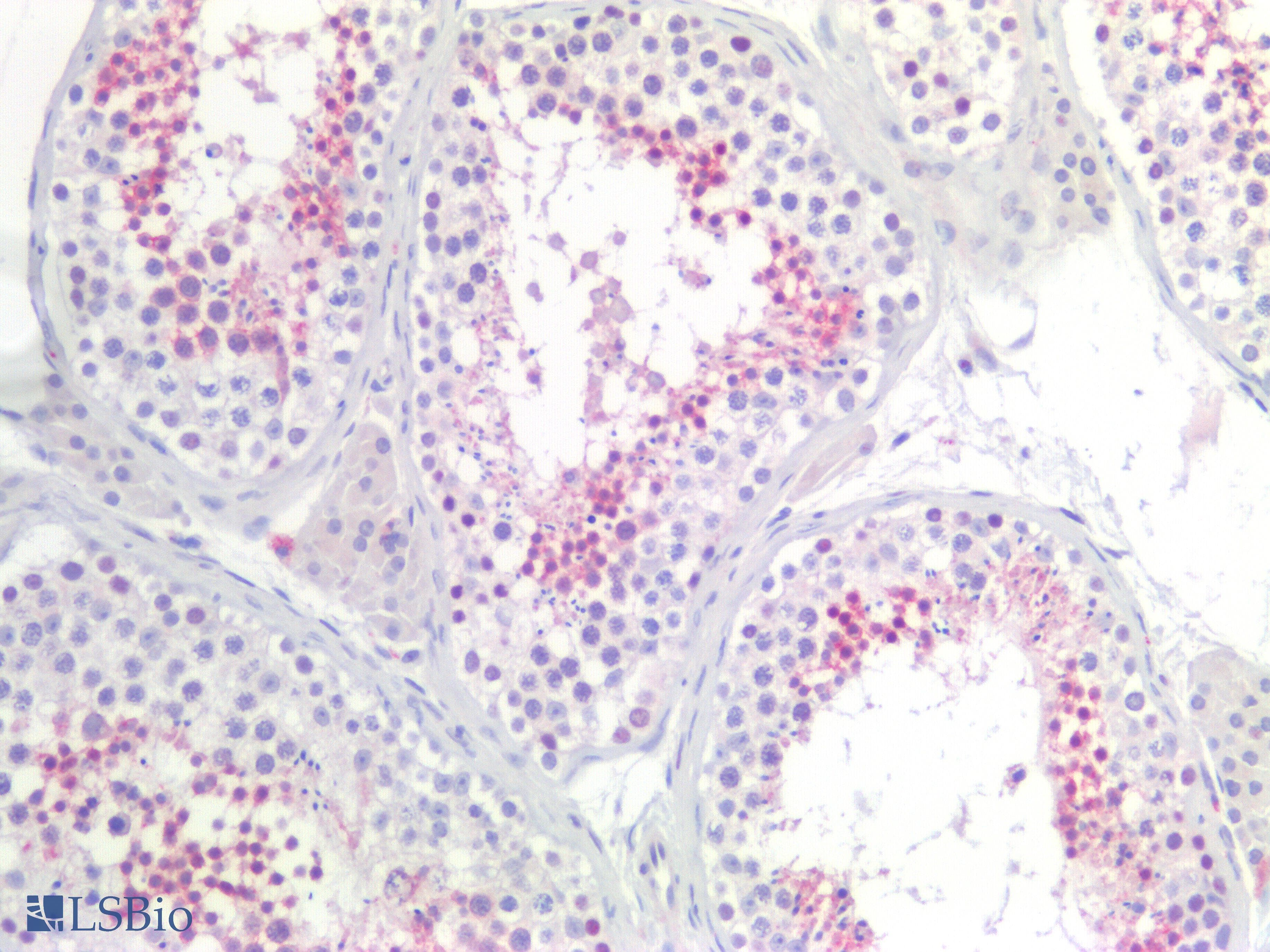 SLC26A8 / TAT1 Antibody (aa664-970)