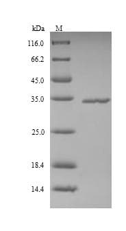 Human FCN2 / Ficolin-2 Protein (Recombinant 6His, N-terminus)