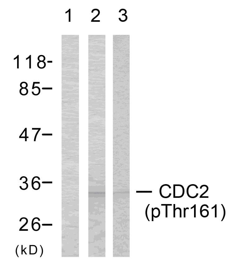 CDK1 / CDC2 Antibody (phospho-Thr161)