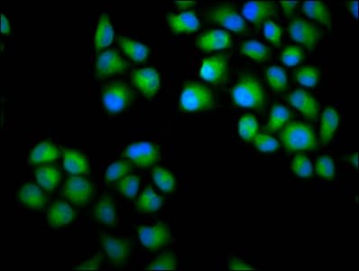 CHODL / Chondrolectin Antibody