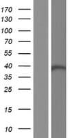 HDS / DHDDS Protein (Over-Expression Lysate Myc-DDK (Flag))