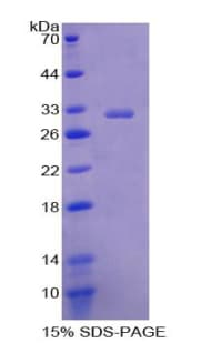 Rat PLAP / Alkaline Phosphatase Protein (Recombinant His, N-Terminal)