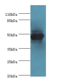 Polyclonal Rabbit anti-Human CKMT2 Antibody (aa40-230, IHC, WB)