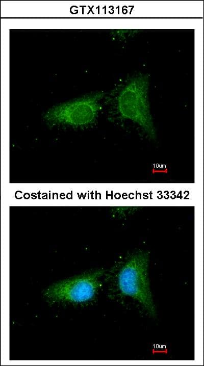 COPB1 / Beta-COP Antibody