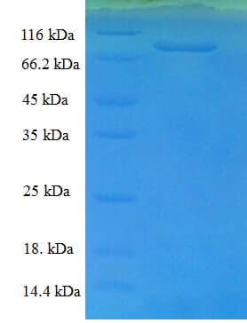 Mouse CFB / Complement Factor B Protein (Recombinant 6His, N-terminus)