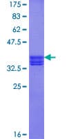 Human ZAN / Zonadhesin Protein (Recombinant GST, N-terminus)