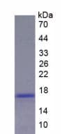 Rat REN / Renin 1 Protein (Recombinant His, N-Terminal)